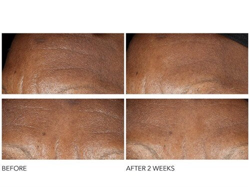Advanced Retinol + Ferulic