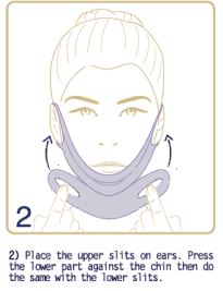 Platysma