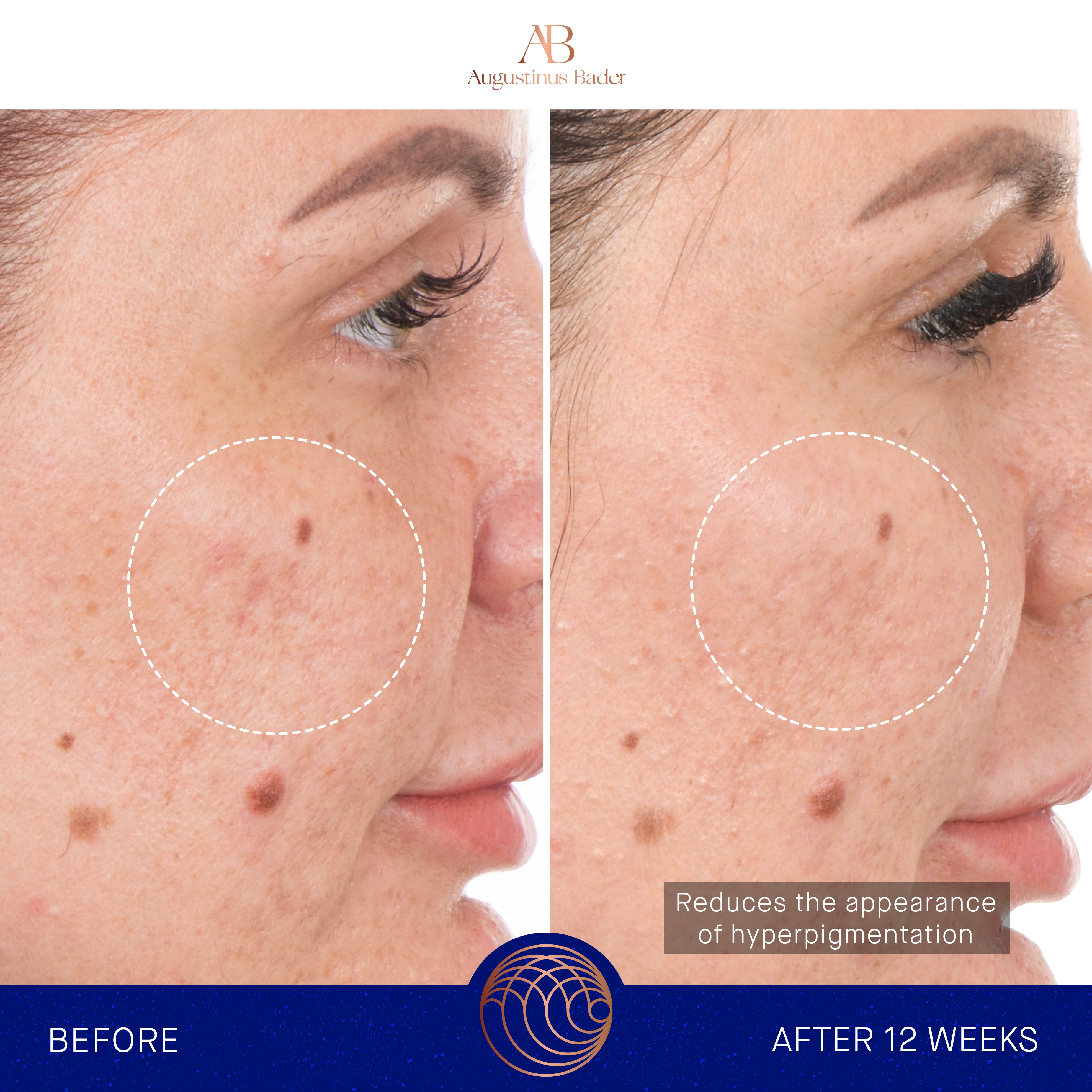 Augustinus Bader The Retinol Serum | Powered by TFC8 | Pure Retinol